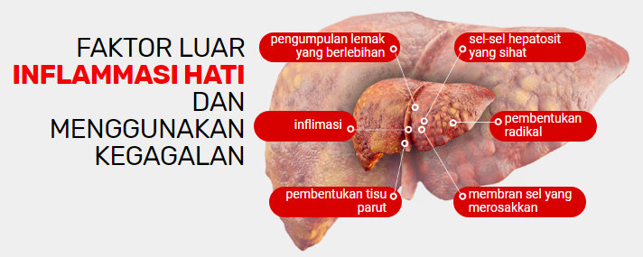 Healthy Liver Malaysia pendapat, harga, beli: anda pasti 