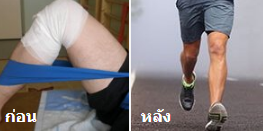 รีวิวMotion Free