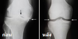 Motion Free วิธีใช้