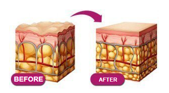 Gialuronix gel forum