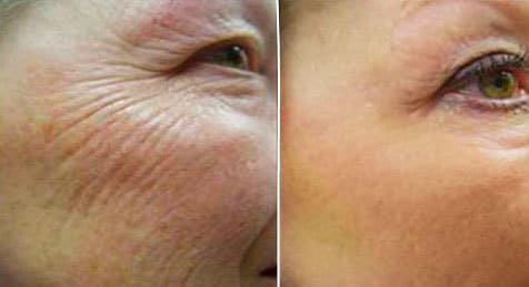 goji cream reviews
