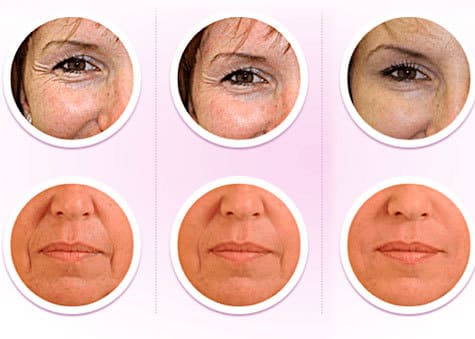 goji cream for wrinkles